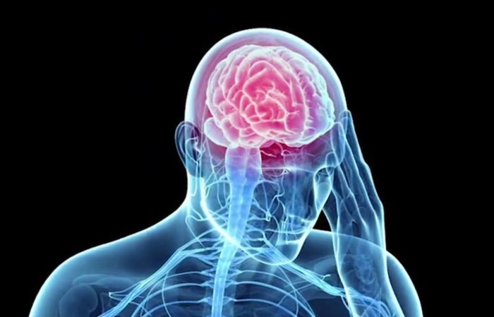 Hesi case study traumatic brain injury